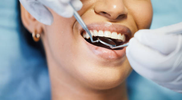 Best Emergency Dentist for Lost Fillings or Crowns in South Rockwood, MI