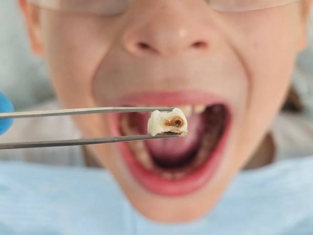 Best Emergency Dentist for Special Needs Patients in South Rockwood, MI